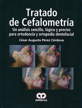 TRATADO DE CEFALOMETRÍA, UN ANÁLISIS SENCILLO, LÓGICO Y PRECISO