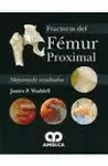 FRACTURAS DEL FEMUR PROXIMAL