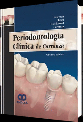 PERIODONTOLOGIA CLINICA DE CARRANZA 8ED