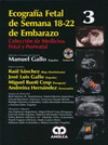 ECOGRAFIA FETAL DE SEMANA 18-22 DE EMBARAZO