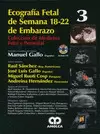 ECOGRAFIA FETAL DE SEMANA 18-22 DE EMBARAZO
