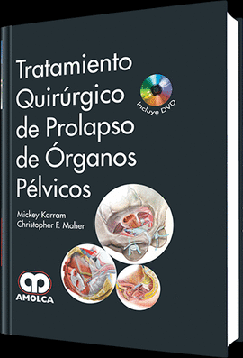 TRATAMIENTO QUIRÚRGICO DE PROLAPSO DE ÓRGANOS PÉLVICOS