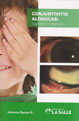 CONJUNTIVITIS ALERGICAS