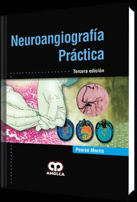 NEUROANGIOGRAFÍA PRÁCTICA 3/EDICIÓN