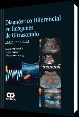 DIAGNÓSTICO DIFERENCIAL EN IMÁGENES DE ULTRASONIDO 2/EDICIÓN