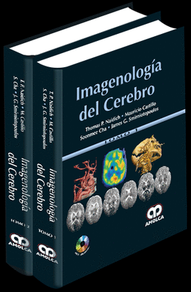 IMAGENOLOGÍA DEL CEREBRO