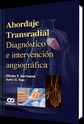 ABORDAJE TRANSRADIAL DIAGNÓSTICO E INTERVENCIÓN   ANGIOGRÁFICA