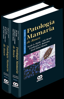PATOLOGÍA MAMARIA DE ROSEN
