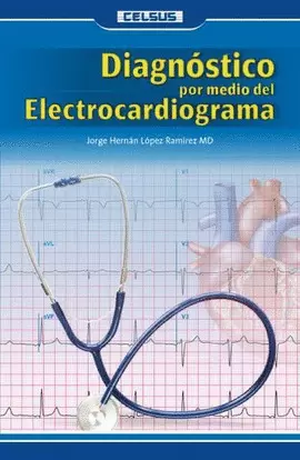 DIAGNÓSTICO POR MEDIO DEL ELECTROCARDIOGRAMA