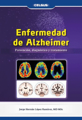 ENFERMEDAD DE ALZHEIMER. PREVENCIÓN, DIAGNÓSTICO Y TRATAMIENTO