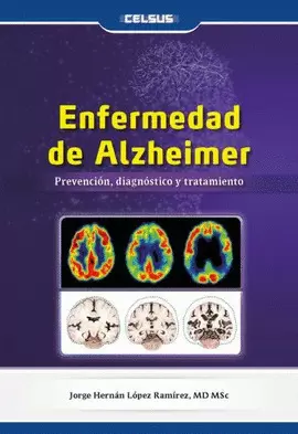 ENFERMEDAD DE ALZHEIMER. PREVENCIÓN, DIAGNÓSTICO Y TRATAMIENTO