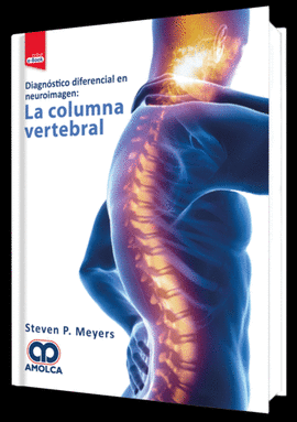 DIAGNOSTICO DIFERENCIAL EN NEUROIMAGEN: LA COLUMNA VERTEBRAL