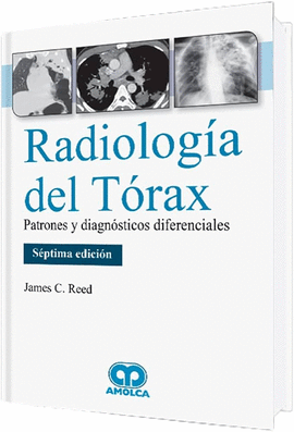 RADIOLOGÍA DEL TÓRAX PATRONES Y DIAGNÓSTICOS DIFERENCIALES 7A. EDICION