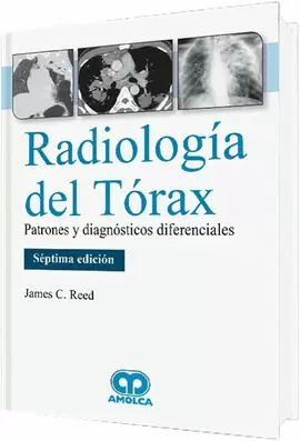 RADIOLOGÍA DEL TÓRAX PATRONES Y DIAGNÓSTICOS DIFERENCIALES 7A. EDICION