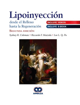 LIPOINYECCION DESDE EL RELLENO HASTA LA REGENERACION