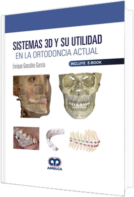 SISTEMA 3D Y SU UTILIDAD EN LA ORTODONCIA ACTUAL