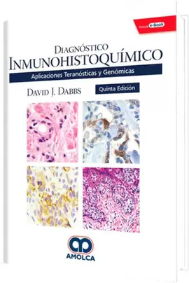 DIAGNÓSTICO INMUNOHISTOQUÍMICO APLICACIONES TERANÓSTICAS Y GENÓMICASR