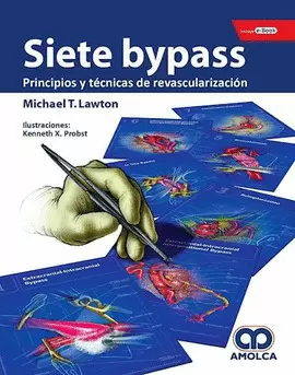 SIETE BYPASS PRINCIPIOS Y TÉCNICAS DE REVASCULARIZACIÓN