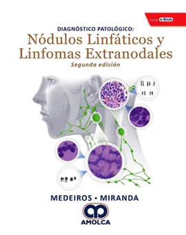 DIAGNÓSTICO PATOLÓGICO NÓDULOS LINFÁTICOS Y LINFOMAS EXTRANODALES