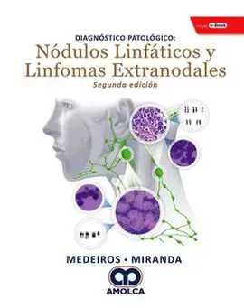 DIAGNÓSTICO PATOLÓGICO NÓDULOS LINFÁTICOS Y LINFOMAS EXTRANODALES
