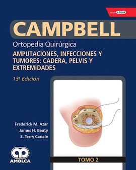 CAMPBELL VOL 2- AMPUTACIONES, INFECCIONES Y TUMORES
