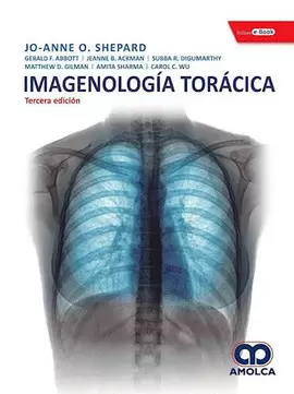 IMAGENOLOGÍA TORÁCICA
