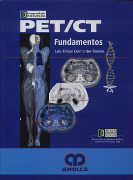 PET/CT FUNDAMENTOS