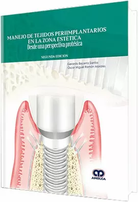 MANEJO DE TEJIDOS  PERIIMPLANTARIOS EN LA ZONA 2A. EDICION