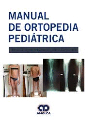 MANUAL DE ORTOPEDIA PEDIATRICA