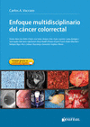 ENFOQUE MULTIDISCIPLINARIO DEL CANCER COLORRECTAL