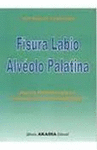 FISURA LKABIO ALVEOLO PALATINA