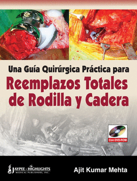 UNA GUIA QUIRURGICA PRACTICA PARA REEMPLAZOS TOTALES DE RODILLA Y CADERA (+ DVD-