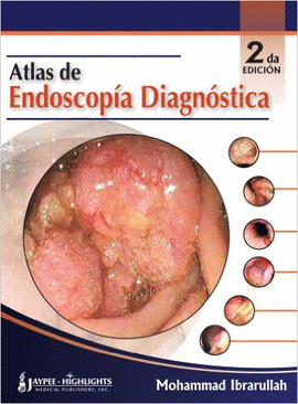 ATLAS DE ENDOSCOPÍA DIAGNÓSTICA, 2/E